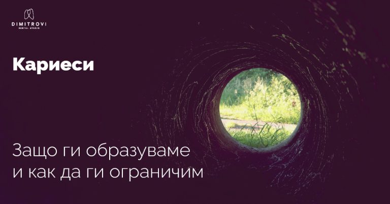 Кариеси – защо се образуват и как да ги предотвратим