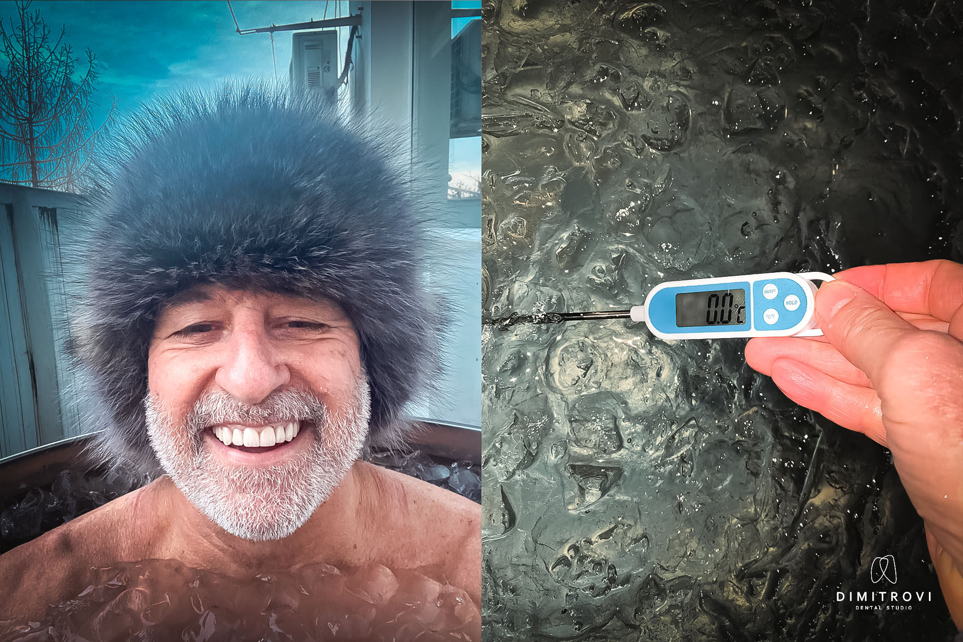 Забравихме да попитаме… тракат ли зъбите във вода 0 градуса?