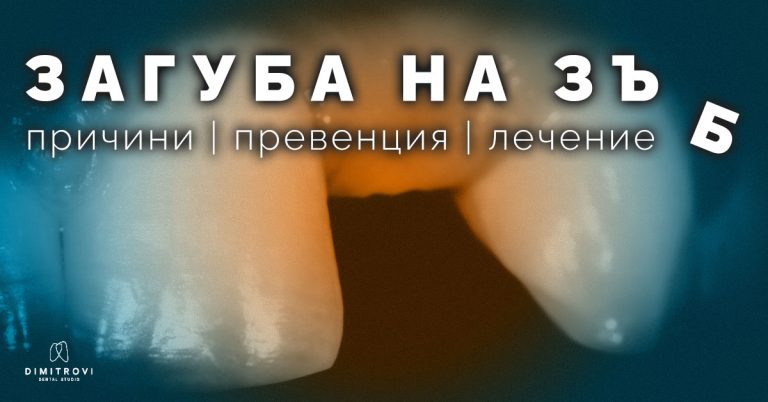 Загуба на зъб – причини, превенция, лечение